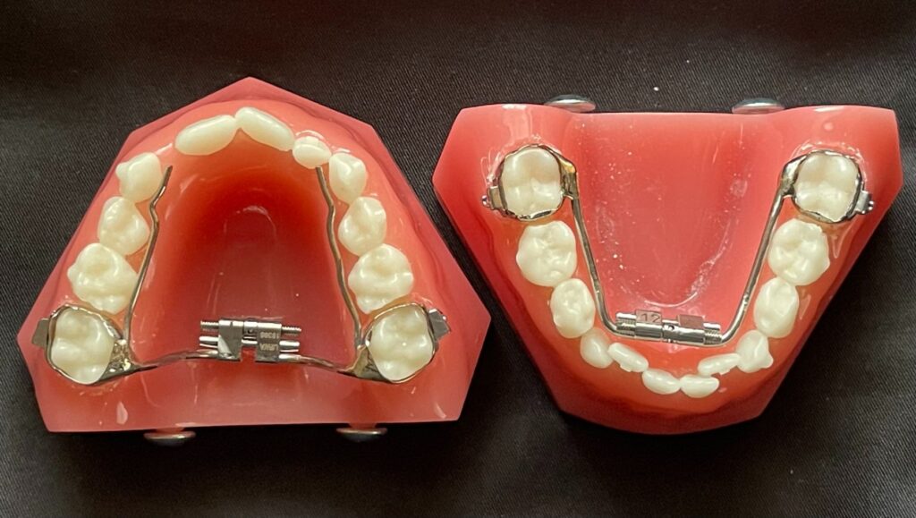 Orthodontic Expanders